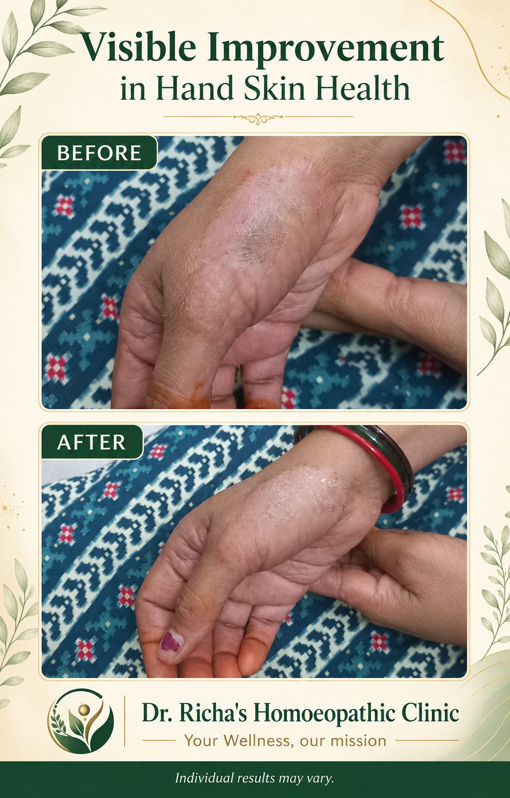 Patient testimonial screenshot 3 for Dr. Richa's Homoeopathic Clinic