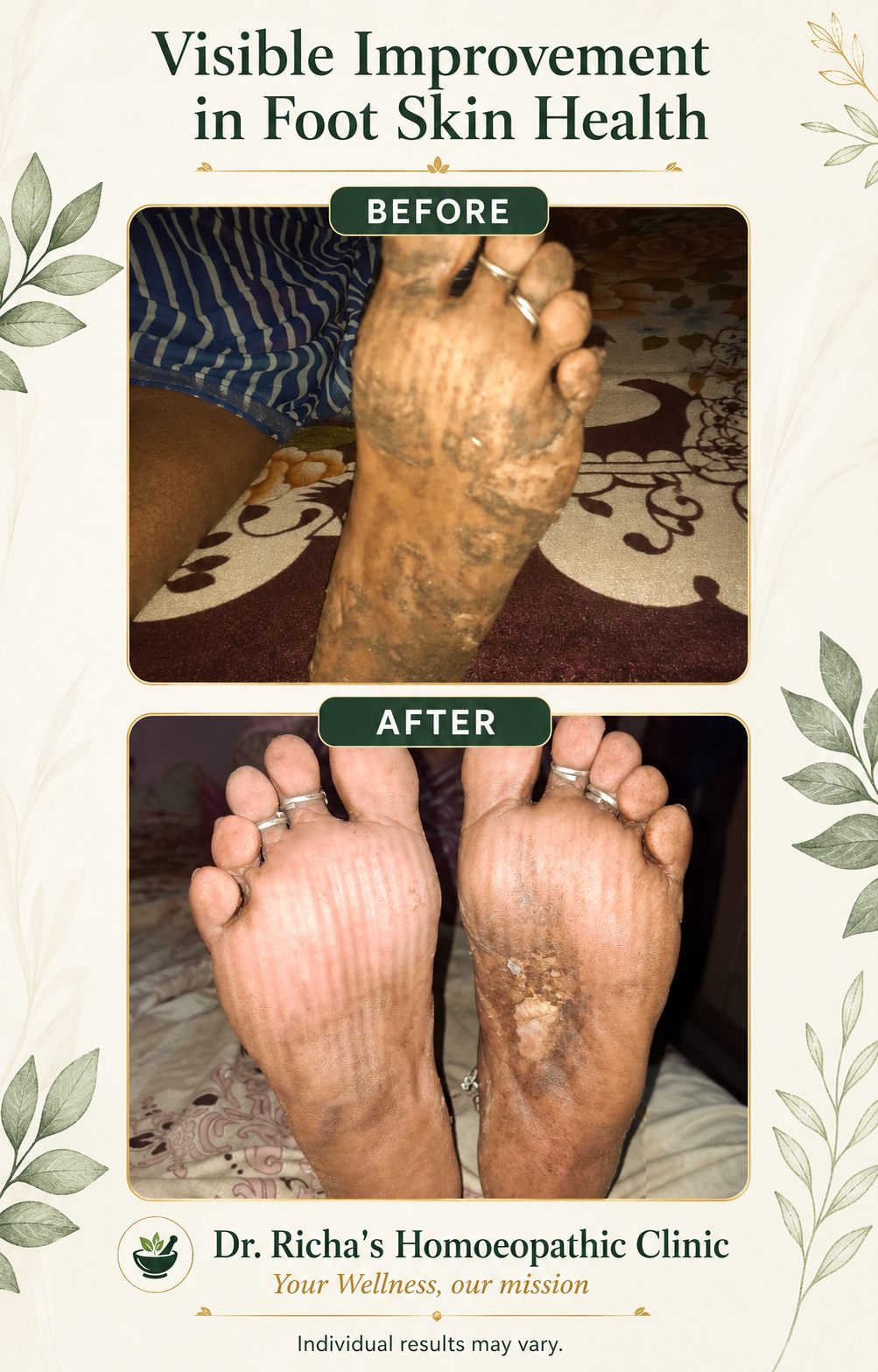 Patient testimonial screenshot 5 for Dr. Richa's Homoeopathic Clinic