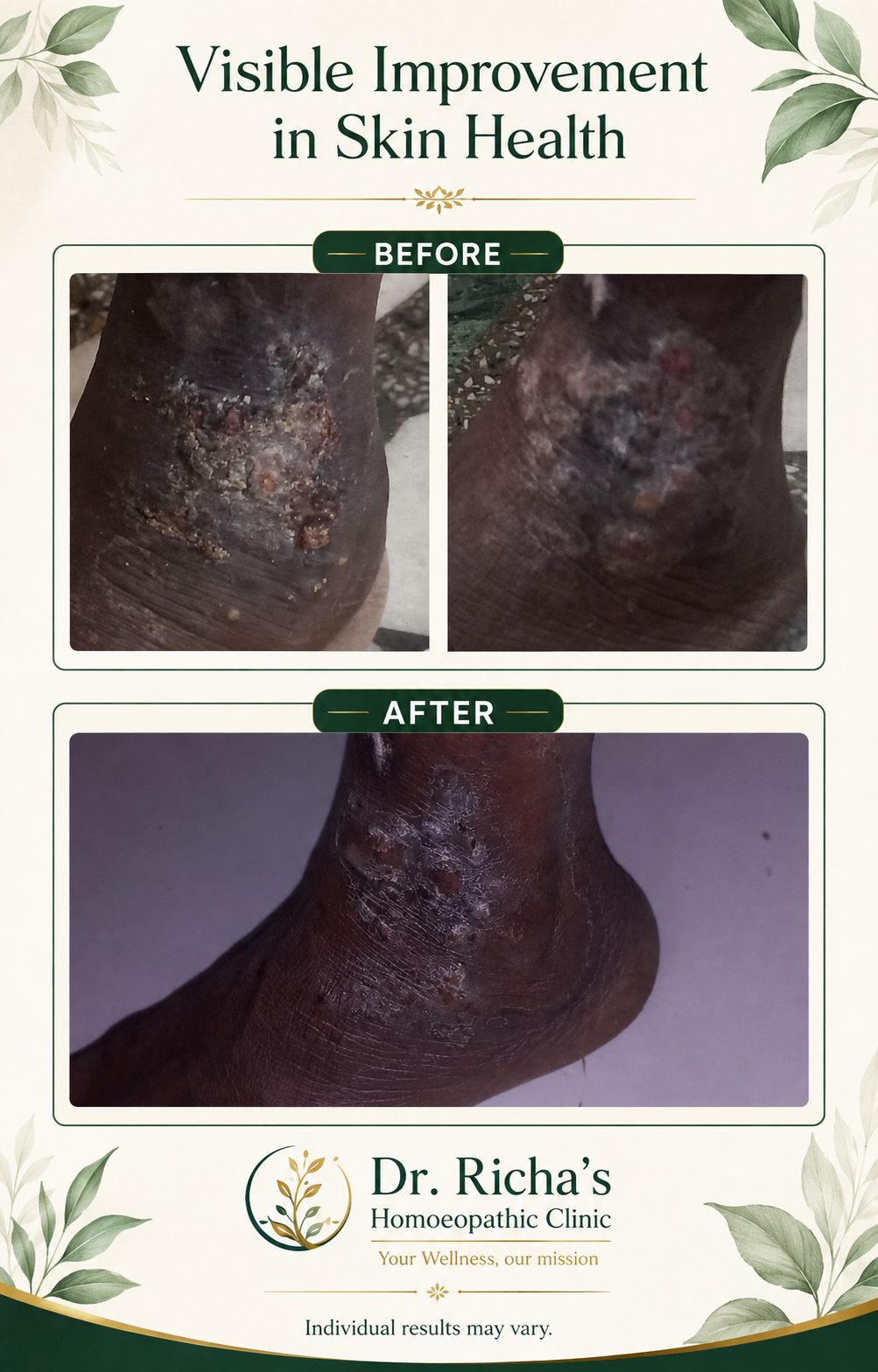 Patient testimonial screenshot 6 for Dr. Richa's Homoeopathic Clinic