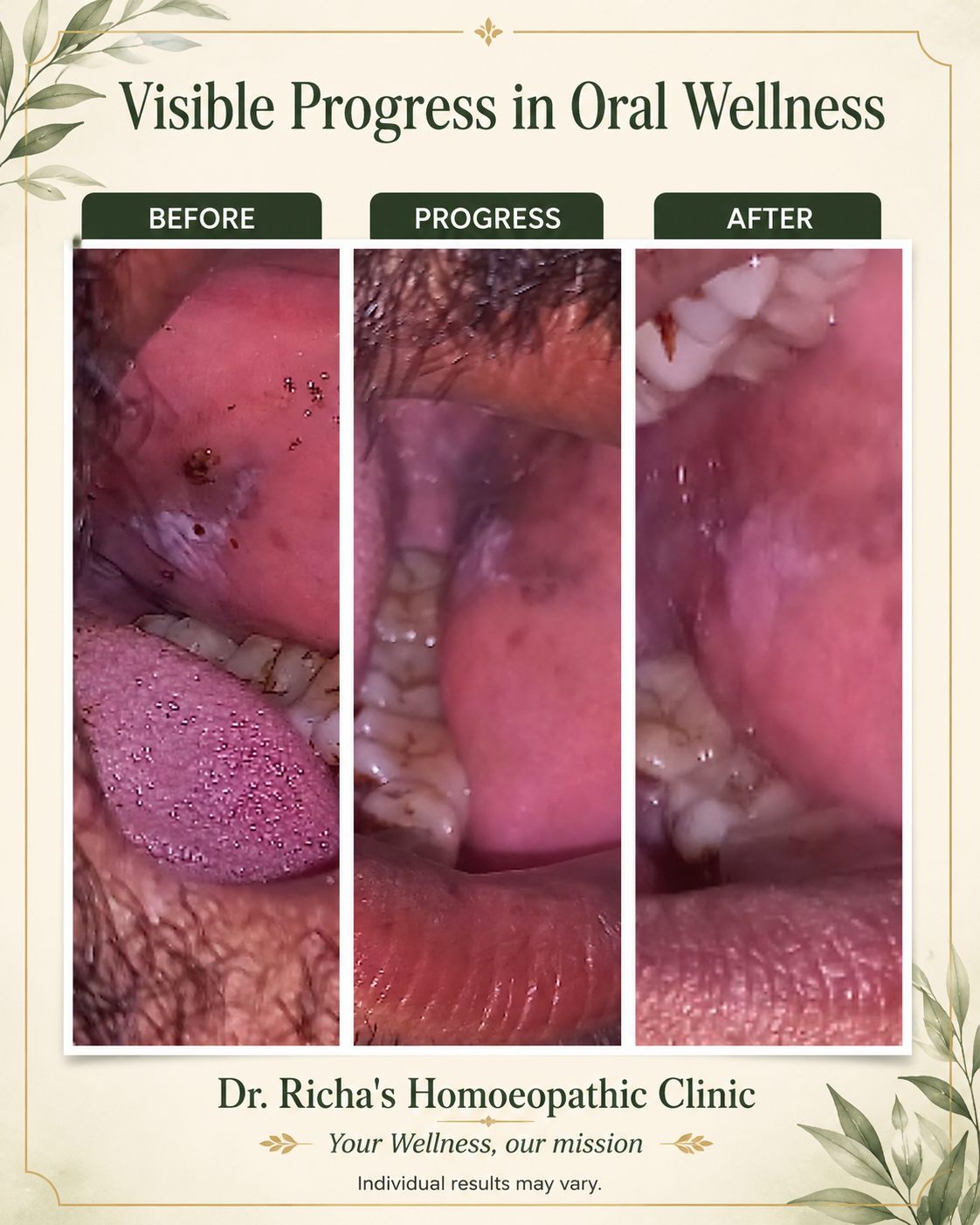 Patient testimonial screenshot 7 for Dr. Richa's Homoeopathic Clinic